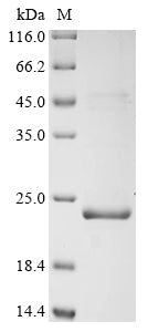 Greater than 90% as determined by SDS-PAGE.Recombinant Measles Virus Phosphoprotein (P/V) Protein (His-KSI)
