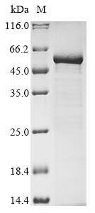 Greater than 85% as determined by SDS-PAGE.Recombinant Vesicular Stomatitis Indiana Virus Nucleoprotein (N) Protein (His&Myc)