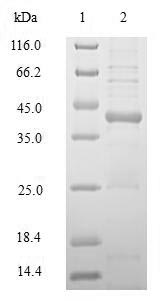 Greater than 90% as determined by SDS-PAGE.Recombinant Human Hla Class Ii Histocompatibility Antigen, Drb1 Beta Chain (HLA-DRB1) Protein (His-SUMO&Myc)