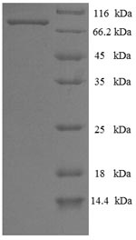 Greater than 90% as determined by SDS-PAGE.Recombinant Influenza B Virus Nucleoprotein (NP) Protein (His-SUMO)