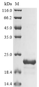 Greater than 85% as determined by SDS-PAGE.Recombinant Pseudomonas Aeruginosa Type Iv Major Pilin Protein Pila (PILA) Protein (His&Myc)