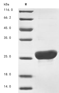 Greater than 90% as determined by SDS-PAGE.Recombinant Mouse Major Urinary Protein 11 (MUP11) Protein (His)