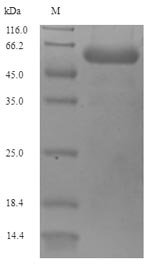 Greater than 90% as determined by SDS-PAGE.Recombinant Pseudomonas Aeruginosa Porin P (OPRP) Protein (His-SUMO)