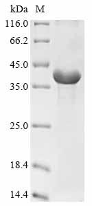 Greater than 85% as determined by SDS-PAGE.