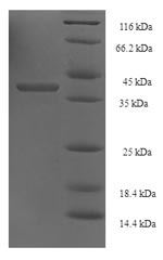 Greater than 90% as determined by SDS-PAGE.Recombinant Saccharomyces Cerevisiae Dna Repair And Recombination Protein Rad52 (RAD52) Protein (His-SUMO)