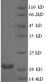 Greater than 90% as determined by SDS-PAGE.Recombinant Human Papillomavirus Type 18 Protein E7 (E7) Protein (His)