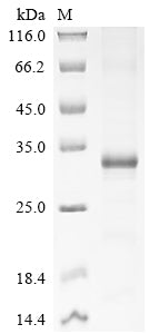 Greater than 85% as determined by SDS-PAGE.