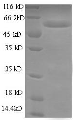 Greater than 90% as determined by SDS-PAGE.Recombinant E.Coli Type 1 Fimbrin D-Mannose Specific Adhesin (FIMH) Protein (His-GST)