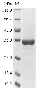 Greater than 85% as determined by SDS-PAGE.Recombinant Semliki Forest Virus Polyprotein P1234 (P1234) Protein (His&Myc)