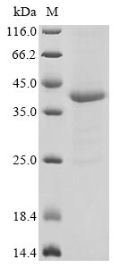 Greater than 85% as determined by SDS-PAGE.