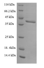 Greater than 90% as determined by SDS-PAGE.