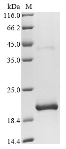 Greater than 90% as determined by SDS-PAGE.Recombinant E.Coli Respiratory Nitrate Reductase 1 Alpha Chain (NARG) Protein (His&Myc)