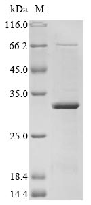 Greater than 85% as determined by SDS-PAGE.Recombinant Zika Virus Genome Polyprotein Protein (His)