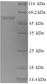 Greater than 90% as determined by SDS-PAGE.Recombinant E.Coli Hygromycin-B 4-O-Kinase (HPH) Protein (His-SUMO)