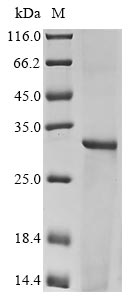 Greater than 90% as determined by SDS-PAGE.Recombinant Human Hla Class Ii Histocompatibility Antigen, Drb1-3 Chain (HLA-DRB1) Protein (His)