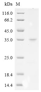 Greater than 90% as determined by SDS-PAGE.Recombinant Ricinus Communis Ricin Protein (His&Myc)