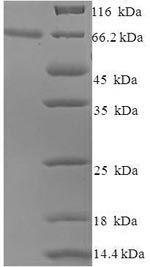 Greater than 90% as determined by SDS-PAGE.Recombinant Human Papillomavirus Type 16 Minor Capsid Protein L2 (L2) Protein (His-SUMO)