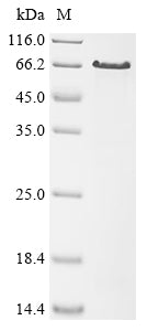 Greater than 85% as determined by SDS-PAGE.Recombinant Human Papillomavirus Type 16 Minor Capsid Protein L2 (L2) Protein (His)