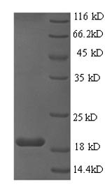 Greater than 90% as determined by SDS-PAGE.Recombinant Human Papillomavirus Type 16 Protein E6 (E6) Protein (His)