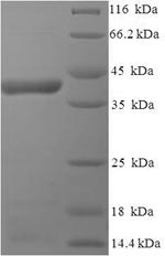 Greater than 90% as determined by SDS-PAGE.Recombinant Human Respiratory Syncytial Virus A Major Surface Glycoprotein G (G) Protein (His-SUMO)
