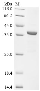 Greater than 85% as determined by SDS-PAGE.Biotinylated Recombinant Human Respiratory Syncytial Virus A Major Surface Glycoprotein G (G) Protein (His-SUMO-Avi)