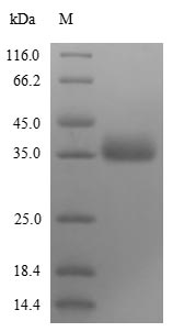 Greater than 85% as determined by SDS-PAGE.Recombinant Influenza B Virus Non-Structural Protein 1 (NS) Protein (His)