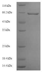 Greater than 90% as determined by SDS-PAGE.Recombinant Rabies Virus Glycoprotein (G) Protein (His-SUMO)