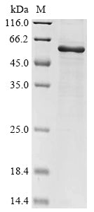 Greater than 90% as determined by SDS-PAGE.Recombinant Rabies Virus Glycoprotein (G) Protein (His)