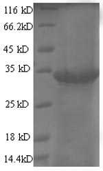 Greater than 90% as determined by SDS-PAGE.