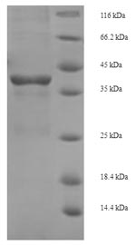 Greater than 90% as determined by SDS-PAGE.Recombinant E.Coli Tetracycline Repressor Protein Class B From Transposon Tn10 (TETR) Protein (His-SUMO)