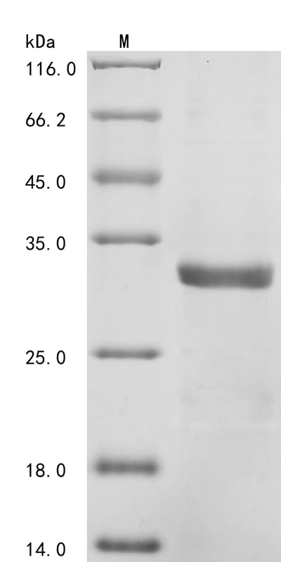 Greater than 85% as determined by SDS-PAGE.Recombinant Mouse C-C Motif Chemokine 21C (CCL21C) Protein (His-SUMO)