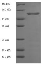 Greater than 90% as determined by SDS-PAGE.Recombinant Aspergillus Niger Probable Alpha-Galactosidase B (AGLB) Protein (His-SUMO)