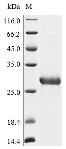 Greater than 90% as determined by SDS-PAGE.Recombinant Bat Coronavirus Hku9 Spike Glycoprotein (S) Protein (His)