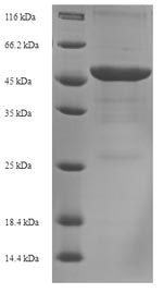 Greater than 90% as determined by SDS-PAGE.Recombinant Acinetobacter Baumannii Outer Membrane Protein Omp38 (OMP38) Protein (His-SUMO)