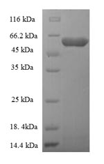 Greater than 90% as determined by SDS-PAGE.Recombinant Rabies Virus Glycoprotein (G) Protein (His-SUMO)