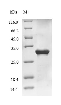 Greater than 85% as determined by SDS-PAGE.Recombinant Influenza A Virus Matrix Protein 1 (M) Protein (His&Myc)