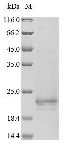 Greater than 85% as determined by SDS-PAGE.Recombinant Influenza A Virus Matrix Protein 2 (M) Protein (His-SUMO&Myc)