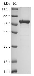 Greater than 85% as determined by SDS-PAGE.Recombinant Leishmania Infantum Thymine Dioxygenase Jbp1 (JBP1) Protein (His-V5)
