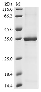 Greater than 85% as determined by SDS-PAGE.