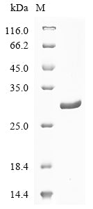 Greater than 90% as determined by SDS-PAGE.Recombinant Cat Plasminogen Activator Inhibitor 1 (PAI-1)