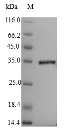 Greater than 90% as determined by SDS-PAGE.Recombinant Clostridium Botulinum Penicillin-Binding Protein 1A (PBPA) Protein (His-SUMO)