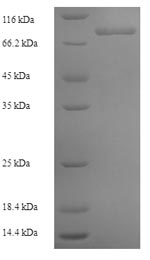 Greater than 90% as determined by SDS-PAGE.Recombinant Human Collagen alpha-6 (COL6A6) Protein (His-SUMO)