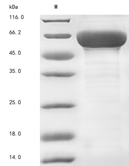 Greater than 85% as determined by SDS-PAGE.Recombinant Human Collagen alpha-6 (COL6A6) Protein (His)