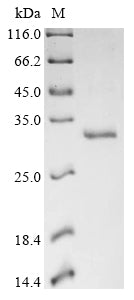 Greater than 90% as determined by SDS-PAGE.Recombinant White-Tufted-Ear Marmoset Thymic Stromal Lymphopoietin (TSLP) Protein (His-SUMO)