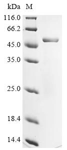Greater than 90% as determined by SDS-PAGE.Recombinant Mouse Angiopoietin-Related Protein 4 (ANGPTL4) Protein (His)