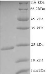 Greater than 90% as determined by SDS-PAGE.Recombinant E.Coli O9:H4 Outer-Membrane Lipoprotein Carrier Protein (LOLA) Protein (His)