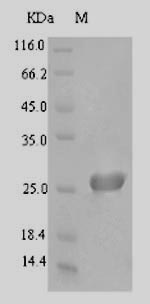 Greater than 90% as determined by SDS-PAGE.
