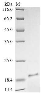 Greater than 85% as determined by SDS-PAGE.Recombinant Mycobacteroides Abscessus Subsp. Abscessus Esat-6-Like Protein (SAMEA2071181_01128) Protein (His&Myc)