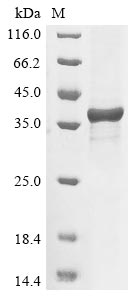 Greater than 85% as determined by SDS-PAGE.Recombinant Brugia malayi tRNA (BM1_01445) Protein (His)