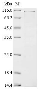 Greater than 85% as determined by SDS-PAGE.Recombinant Rat Cd44 Antigen (CD44) Protein (His)